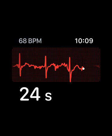 ECG app, beats per minute in top right corner, rhythm line, timer