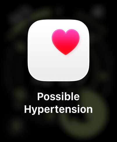 ساعة Apple Watch Ultra 3، إطار تيتانيوم، لون طبيعي، قلب وردي في خانة بيضاء، حزام Loop ترايل، لون أزرق/أزرق ساطع