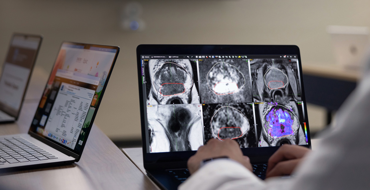 Un MacBook Pro con delle radiografie sullo schermo.