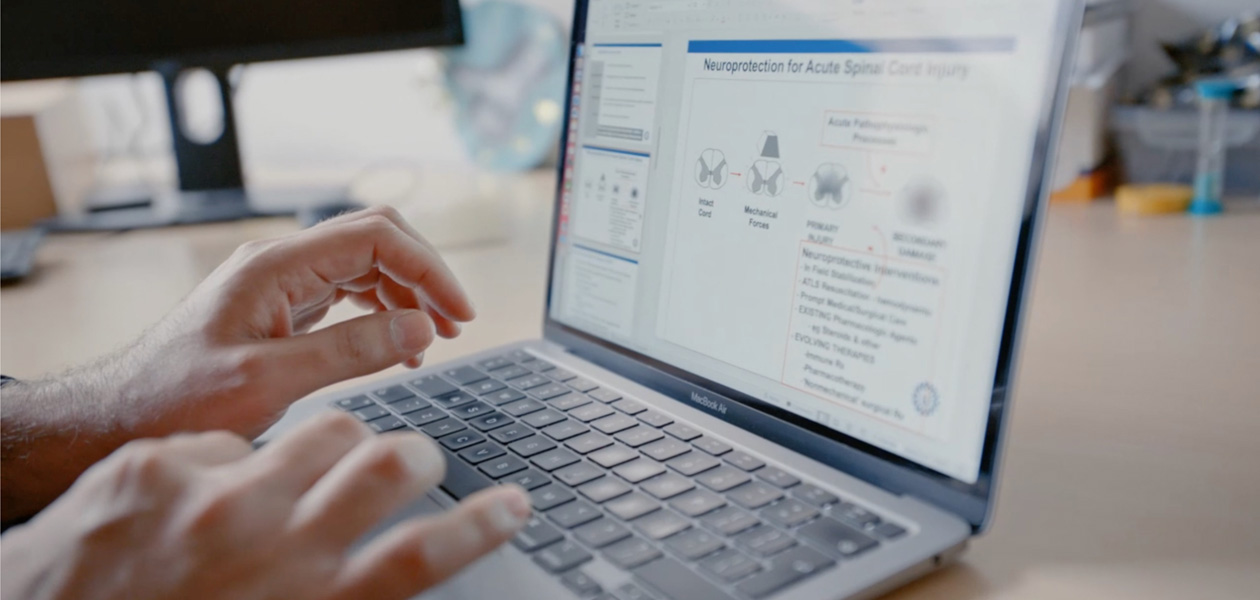 Händer som skriver på en MacBook Pro.