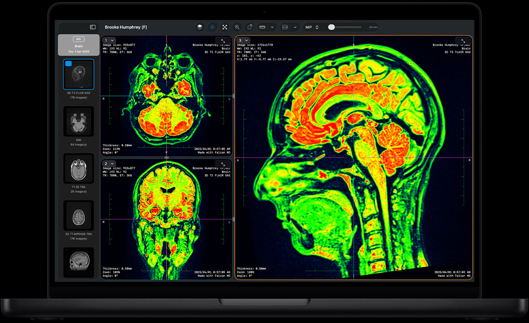 Екран на MacBook Pro, на който се вижда Falcon MD
